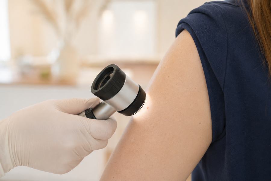 Hautkrebsvorsorge – Hautmedizin Westend
